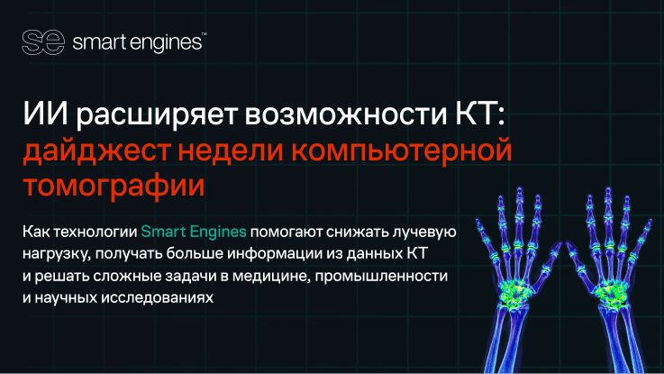 ИИ расширяет возможности компьютерной томографии: дайджест недели Smart Tomo Engine